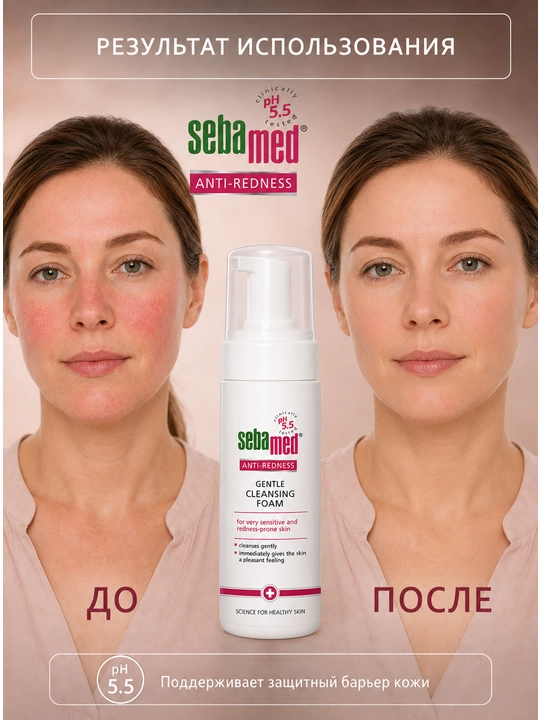 Очищающая пена Sebamed Anti-Redness pH 5.5 для чувствительной кожи с покраснениями