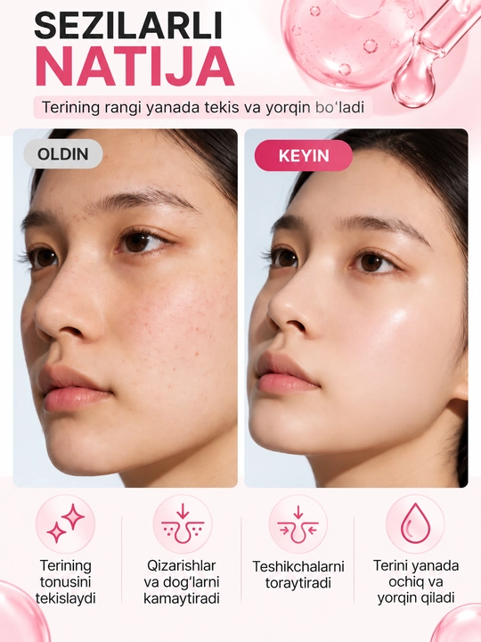 Anua 10+ niacibamid Terini parvarish qilish uchun serum  oqartiruvchi, 30 ml