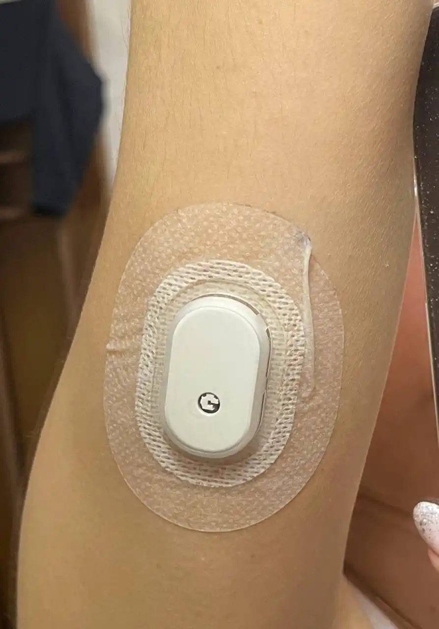 Glyukozani uzluksiz monitoring qilish tizimi (CGM) - Sibionics