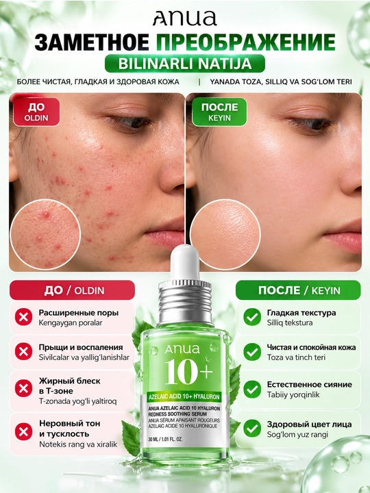 Anua Azelaic Acid 10 Hyaluron Redness Soothing Serum – сыворотка с азелаиновой кислотой