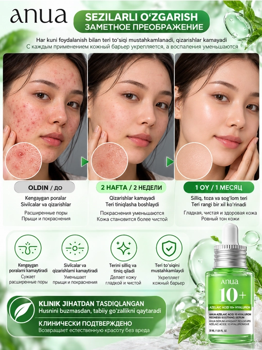 Anua Azelaic Acid 10 Hyaluron Redness Soothing Serum – сыворотка с азелаиновой кислотой