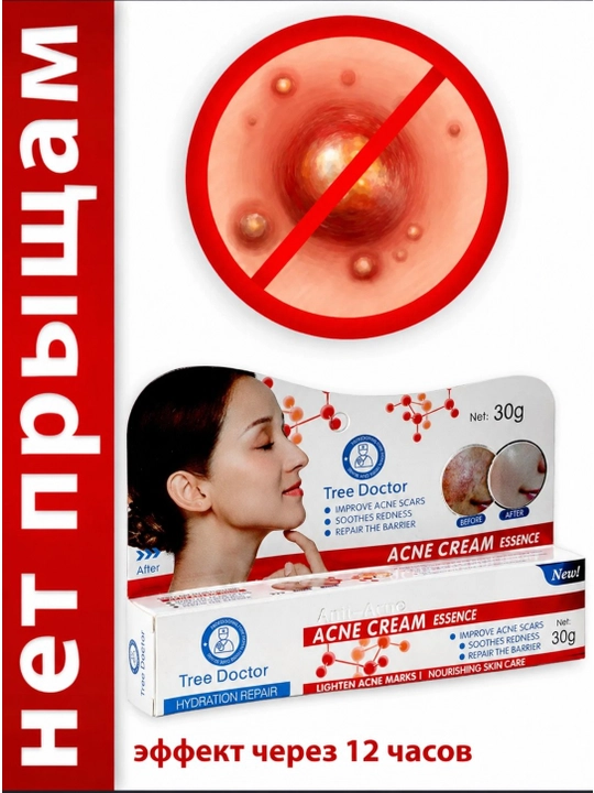 Husnbuzar va ugrilarga qarshi krem Tree Doctor, 30 g - 