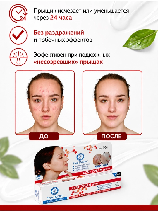Крем от прыщей и акне Tree Doctor, 30 г