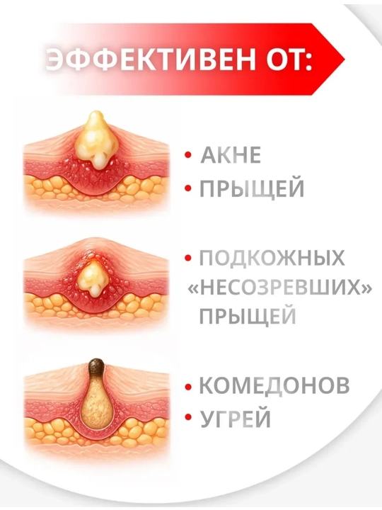Крем от прыщей и акне Tree Doctor, 30 г