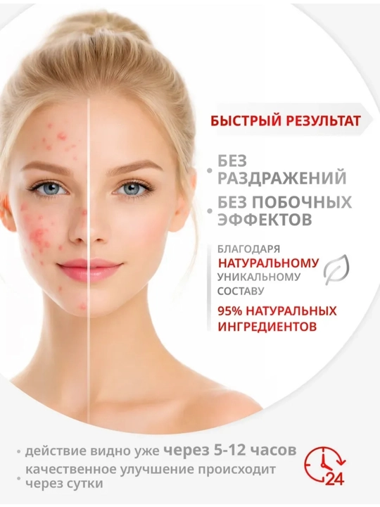 Крем от прыщей и акне Tree Doctor, 30 г
