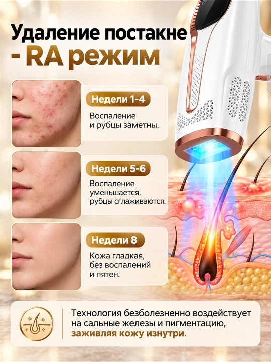 Yuz va tana uchun professional, sovutish effektiga ega fotoepilyator