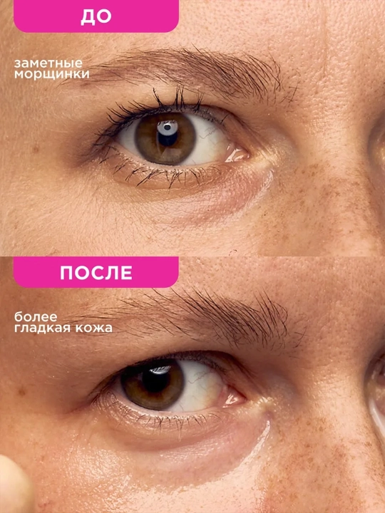 VOIS Патчи для глаз