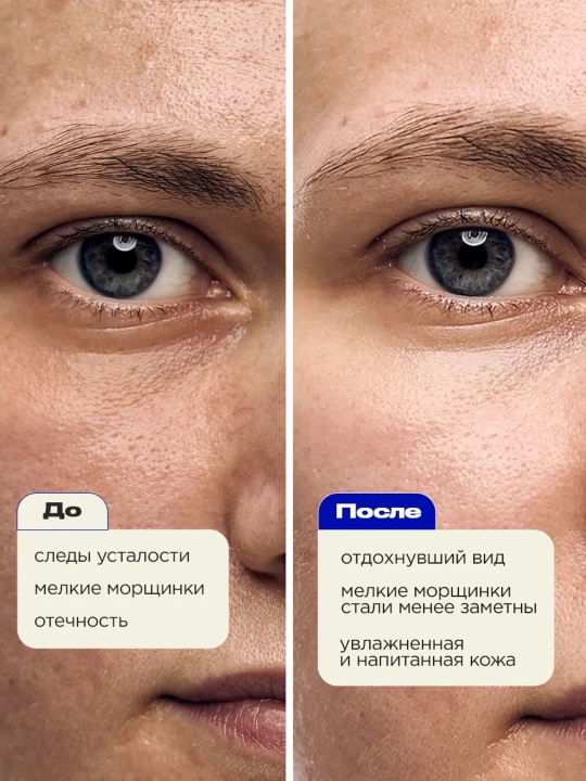 VOIS Патчи для глаз