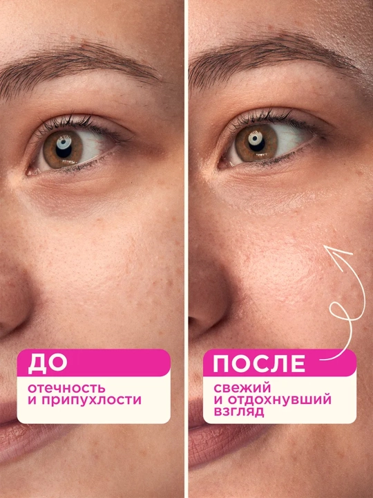 VOIS Патчи для глаз