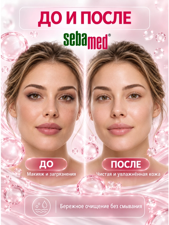 Sebamed Sensitive Skin pH 5.5 mitsellyar suvi — normal va quruq teri uchun