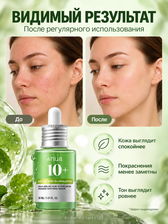Anua сыворотка для лица, азелаиновая кислота, ниацинамид, против акне acid 10 Hyaluron