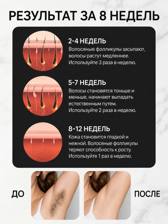 Cronier Фотоэпилятор для лица, зоны бикини и тела, ресурс 999 999 вспышек
