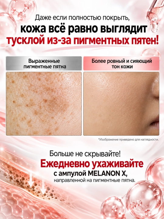 MEDIPEEL Ампула Melanon X против пигментации, ниацинамид + транексамовая кислота, 30 мл