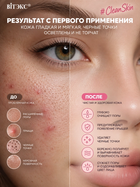 Yuz, husnbuzar va qora nuqtalardan himoyalovchi CLEAN SKIN 3 tasi 1 da, gel-skrab-niqobi