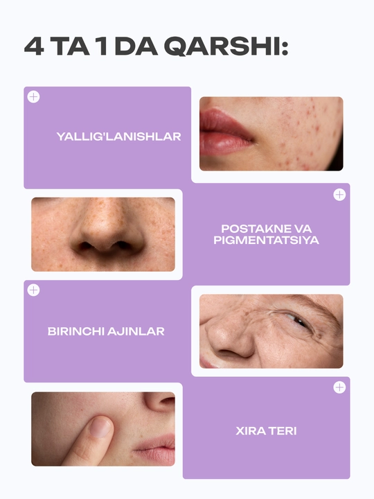 Крем The U Glow Skin Retinol Cream, содержащий 0,3% ретинола и бакучиол для ухода за кожей
