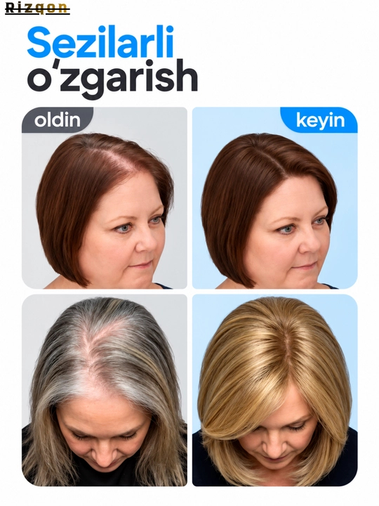 Сыворотка для роста волос Hair Growth Serum Rooll-on Bodywise, 25 мл, от выпадения