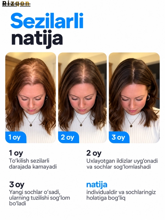 Сыворотка для роста волос Hair Growth Serum Rooll-on Bodywise, 25 мл, от выпадения