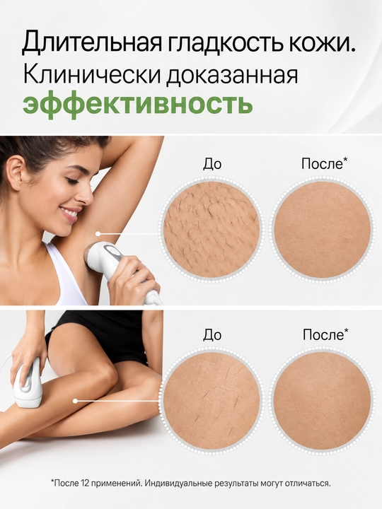 Braun Silk-expertPro 3 PL3221 fotoepilyator, tuklarni yo‘qotish uchun, 300 000 ta chaqnash  
