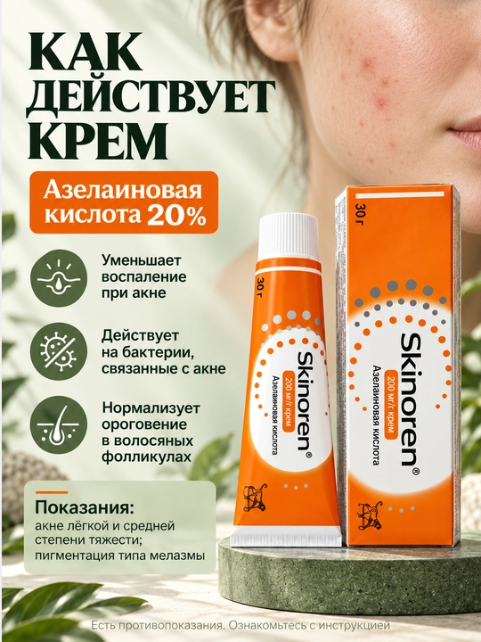 Skinoren 20% yuz kremi, akne, husnbuzar va toshmalarga qarshi, azelain kislotasi, 30 g