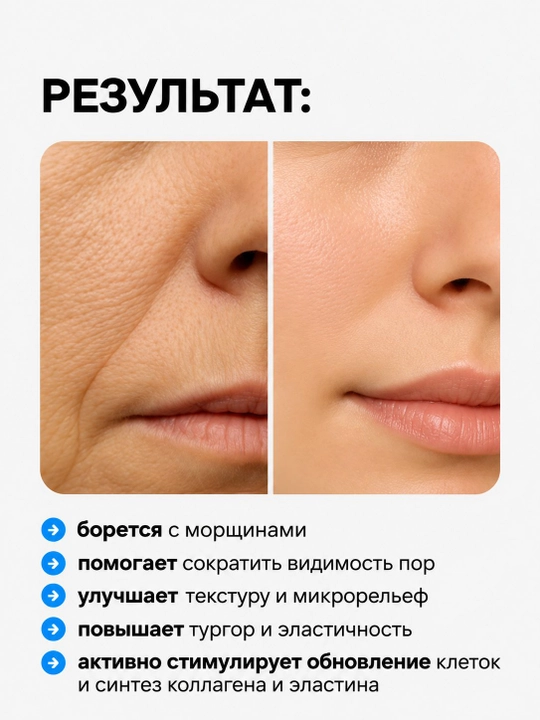 COMPLIMENT PROFESSIONAL SPICULE qarishga qarshi 50ml mikro igna yuz zardobi