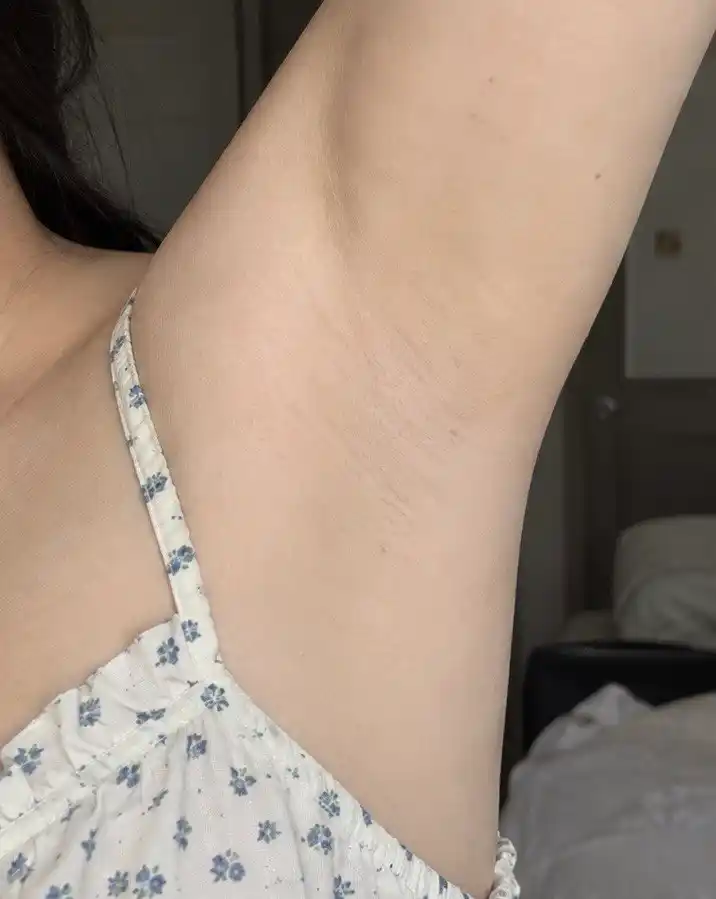 Qo`ltiq osti terisini oqartiruvchi parvarish Beauty 3D Underarm Whitening Cure Cream