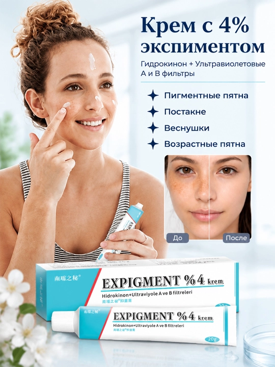Expigment — отбеливающий крем/мазь (4%) от пигментации и веснушек, 20 г