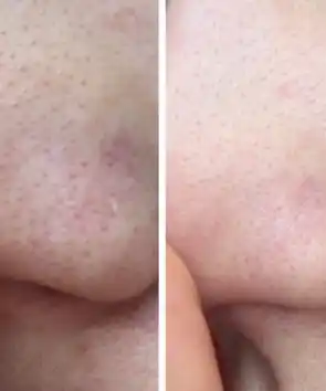Гидрофильное масло для умывания кожи лица и снятия макияжа ZODIAC, от черных точек