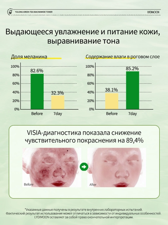 Тоник для лица с ниацинамидом и зелёным чаем, осветляющий и увлажняющий, 120 мл