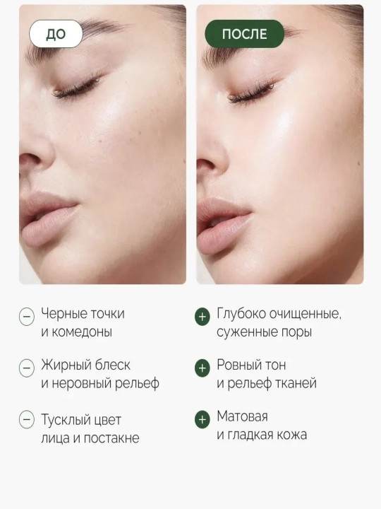 Пенка для умывания Medicube Zero очищающая пор сужения от черных точек корейская, 120 г