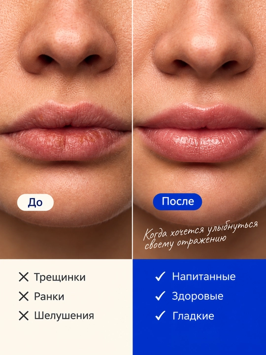 VOIS Маска для губ увлажняющая, бальзам восстанавливающий, 10 мл