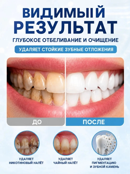 LYDIMOON tish oqartiruvchi kukuni, 50 g