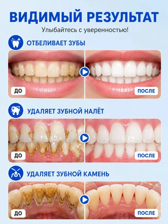 LYDIMOON tish oqartiruvchi kukuni, 50 g