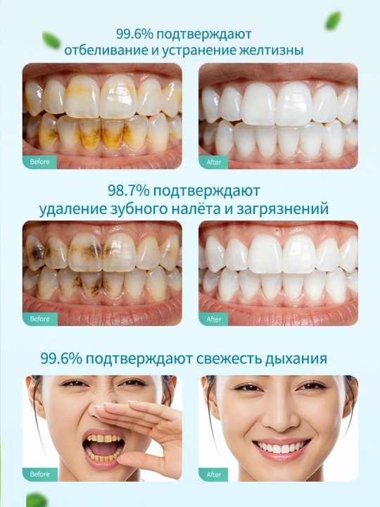Yalpizli oqartiruvchi tish kukuni V34, sariq dog'larga qarshi, nafas yangiligi, 50 g
