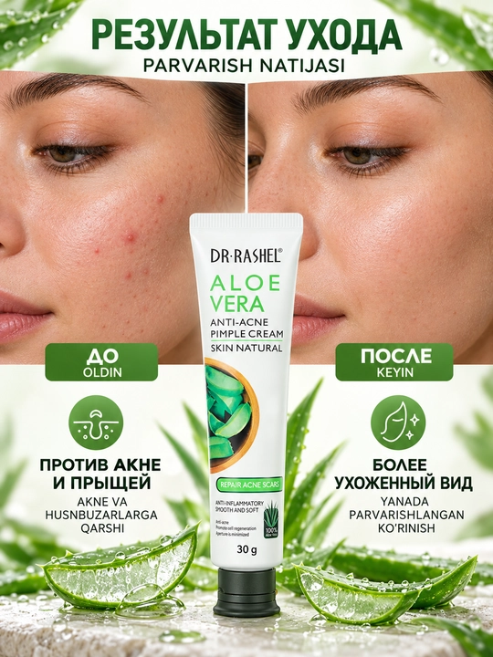 R.Rashel Aloe verali yuz kremi, husnbuzar va aknega moyil muammoli teri uchun, 30 g