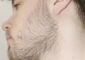Набор Minoxidil 10% миноксидил для роста волос и бороды