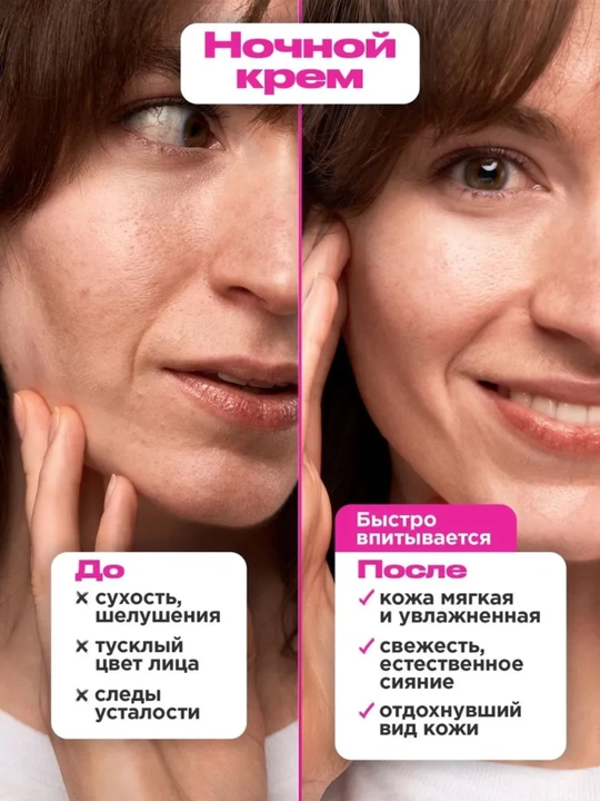 VOIS Кремы для лица: увлажняющий от акне, ночной, ниацинамидом, Q10, антивозрастной, 50 мл