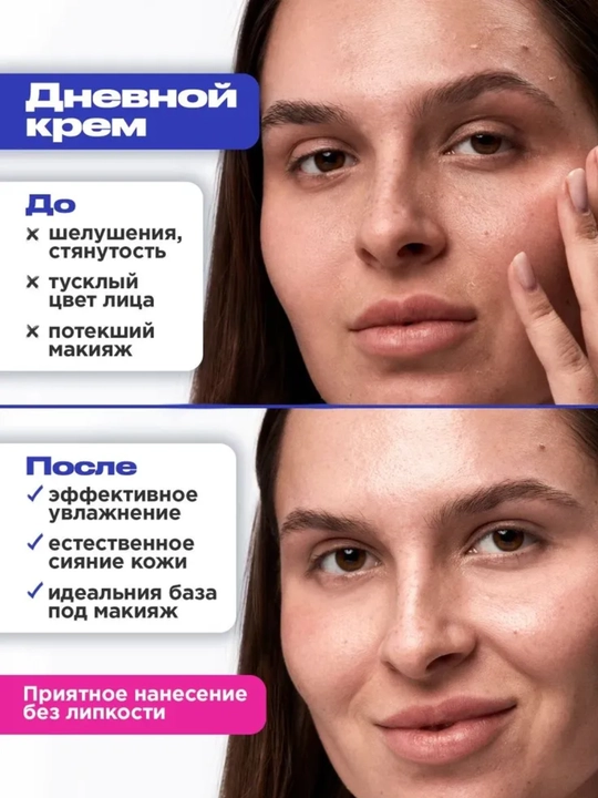 VOIS Кремы для лица: увлажняющий от акне, ночной, ниацинамидом, Q10, антивозрастной, 50 мл