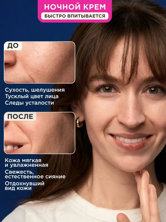 VOIS Кремы для лица: увлажняющий от акне, ночной, ниацинамидом, Q10, антивозрастной, 50 мл