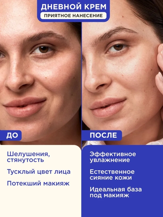 VOIS Кремы для лица: увлажняющий от акне, ночной, ниацинамидом, Q10, антивозрастной, 50 мл