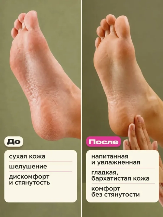 Quruqlik va yoriqlarga qarshi VOIS mochevina va E vitamini qo‘shilgan qo‘l va tana uchun krem-loson, 300 ml