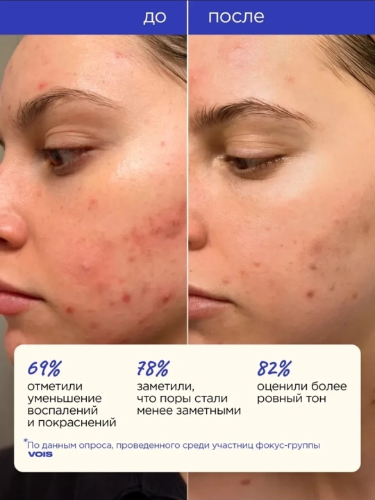 VOIS Набор средств для лица, подарочная упаковка